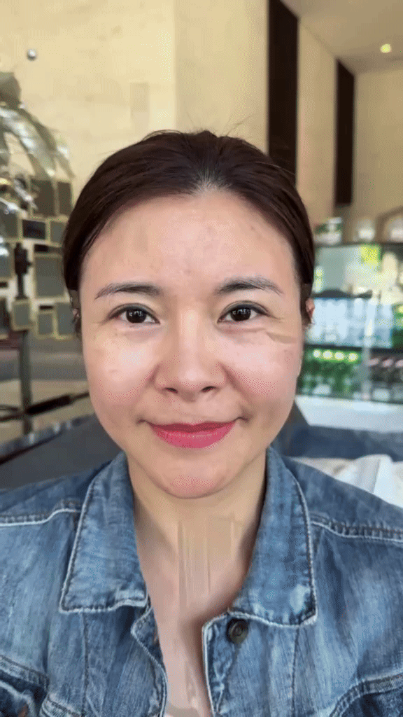 Kim Oanh thực hiện dịch vụ làm đẹp khác nhằm cải thiện đường nét gương mặt