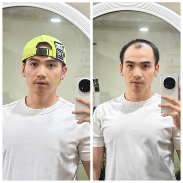 Chồng nàng hậu thời điểm hé lộ lý do phải thường xuyên đội mũ. Chồng hoa hậu H'Hen Niê đội mũ vì hói đầu